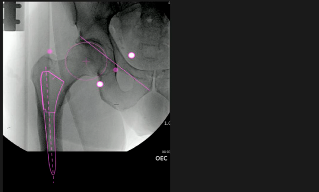Demostraci�n Velys
